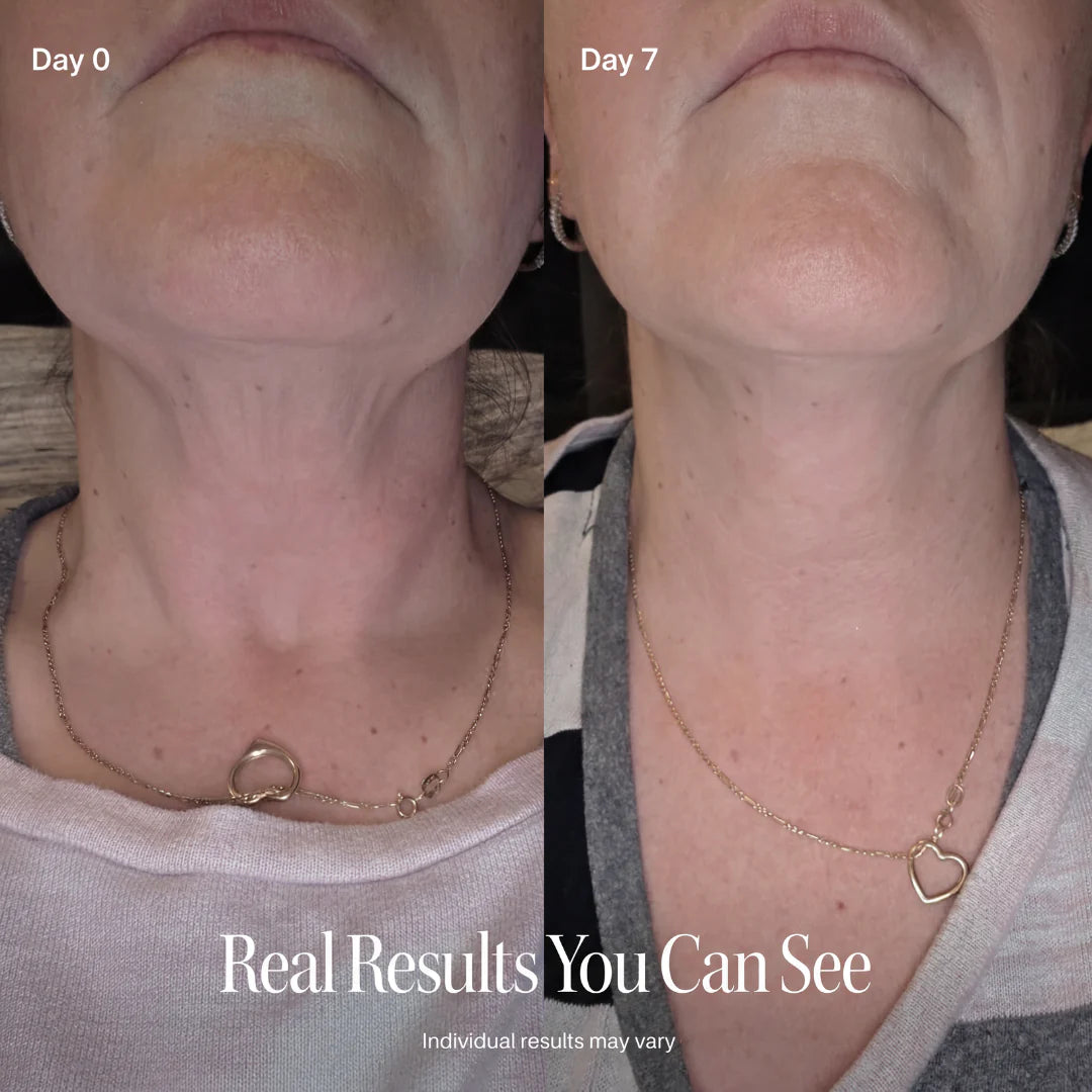 PEPTIDE Face Slimming Cream