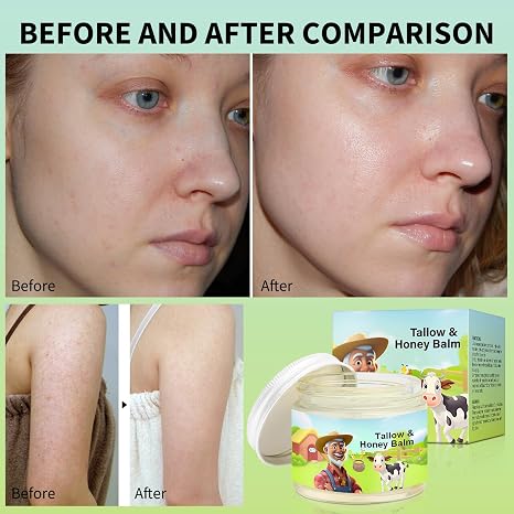 🌟 GRASS-FED TALLOW & HONEY MOISTURIZING BALM 🧈🍯 5346519 🧈 Ultra-Rich Multi-Effect Repair Cream for Face & Body 🍯 One jar replaces your entire moisturizer routine
