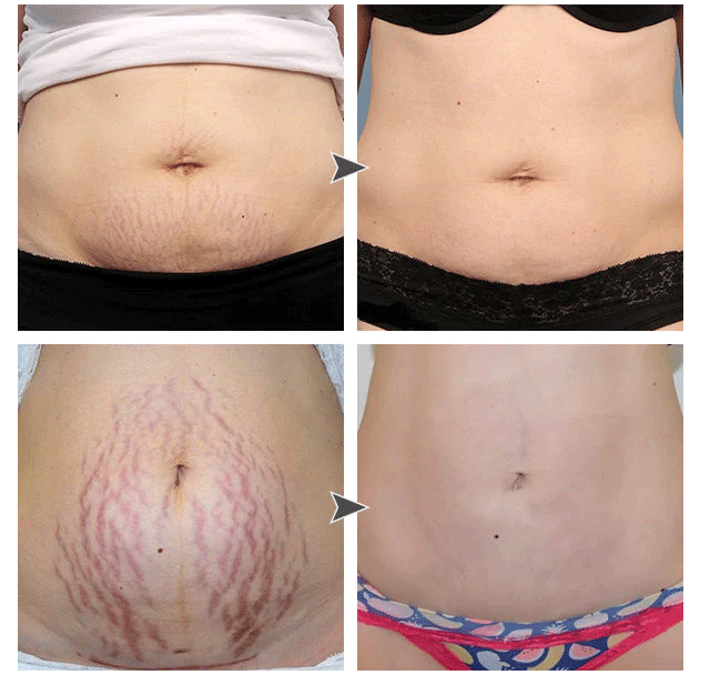 Collagen Lifting Body Oil Thin Leg