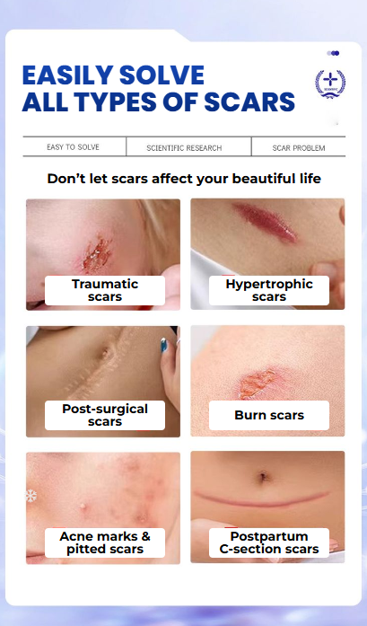 MEJISOO  Reduces pigmentation fades scarsand lightens burns.