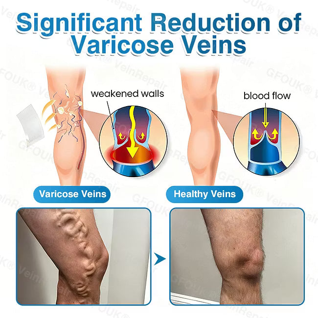 👨‍⚕️✅ VeinRepair Microneedle Patch Roll⚡Instant Relief, Long-Term Results
