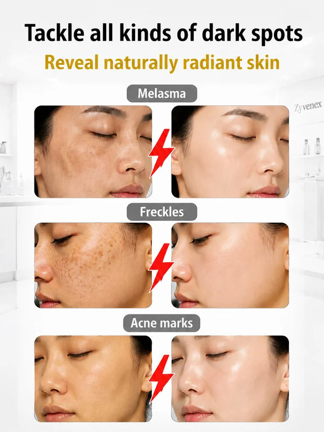 [7-Day Skin Brightening] Brightening Serum