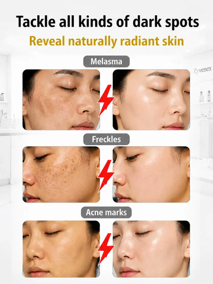 [7-Day Skin Brightening] Brightening Serum