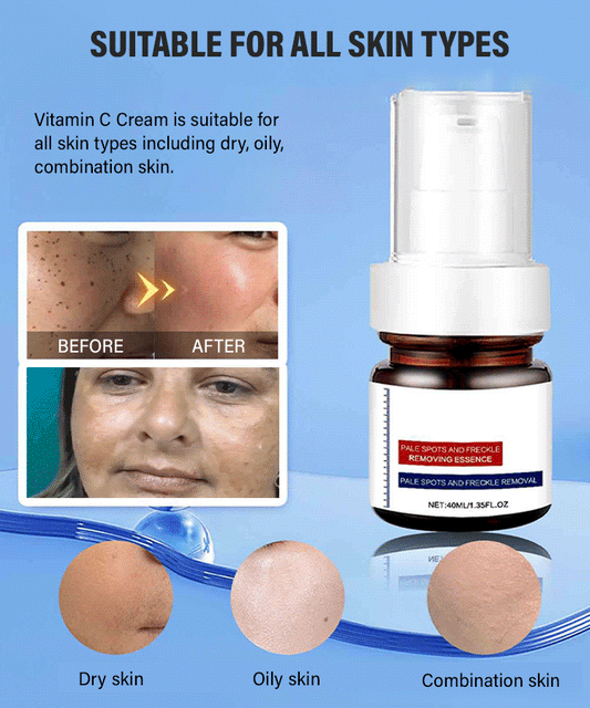 🔥Buy more save more🔥Freckle-Banishing Serum for Face: Repair and Cleanse Dark Spots
