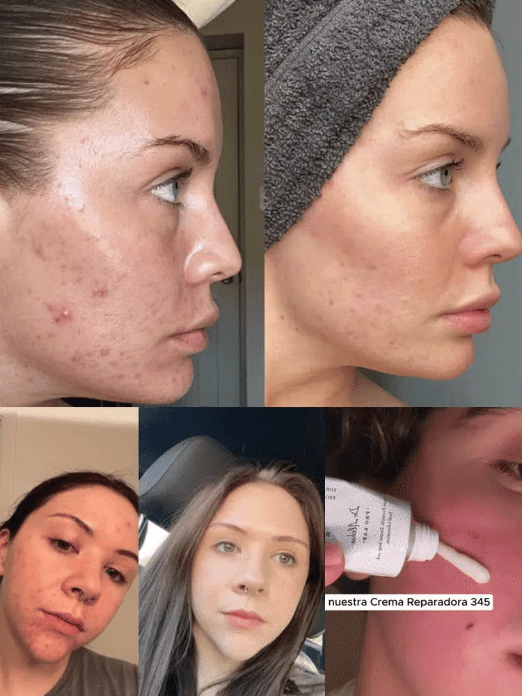 Hyaluronic Acid Soothing Face Cream Deep Hydration Improve Drying Reduce Dullness Repair Skin Barrier Radiance Face Care Lotion