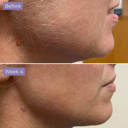 Velura Skin Cyperus Rotundus Serum