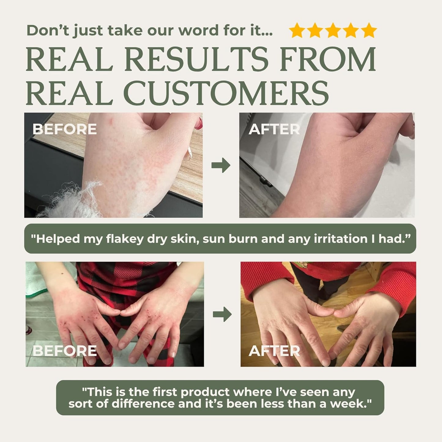🌟 GRASS-FED TALLOW & HONEY MOISTURIZING BALM 🧈🍯 5346519 🧈 Ultra-Rich Multi-Effect Repair Cream for Face & Body 🍯 One jar replaces your entire moisturizer routine