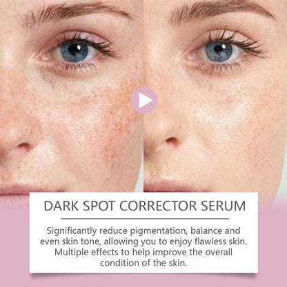 🔥Limited Time Offer🔥Advanced Dark Spot Corrector Serum -Multi-Correction Brightening Formulafor Sun Spots, Age Spots, and Melasma-XXS