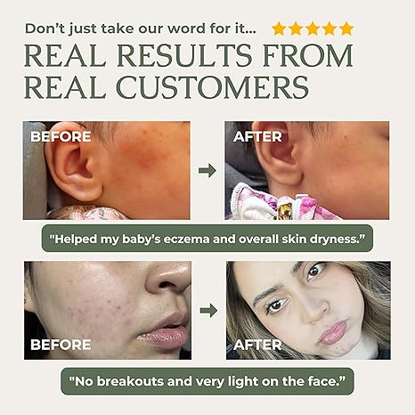 🌟 GRASS-FED TALLOW & HONEY MOISTURIZING BALM 🧈🍯 5346519 🧈 Ultra-Rich Multi-Effect Repair Cream for Face & Body 🍯 One jar replaces your entire moisturizer routine