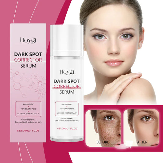🔥Limited Time Offer🔥Advanced Dark Spot Corrector Serum -Multi-Correction Brightening Formulafor Sun Spots, Age Spots, and Melasma-XXS