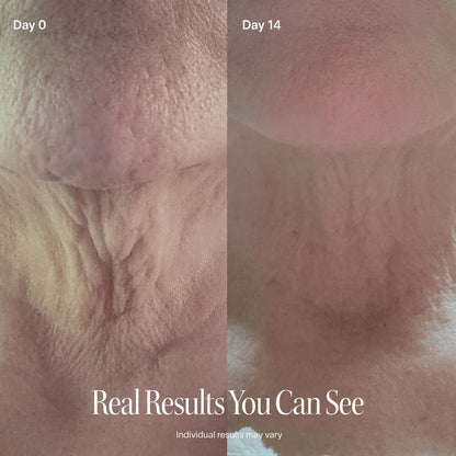 PEPTIDE Face Slimming Cream