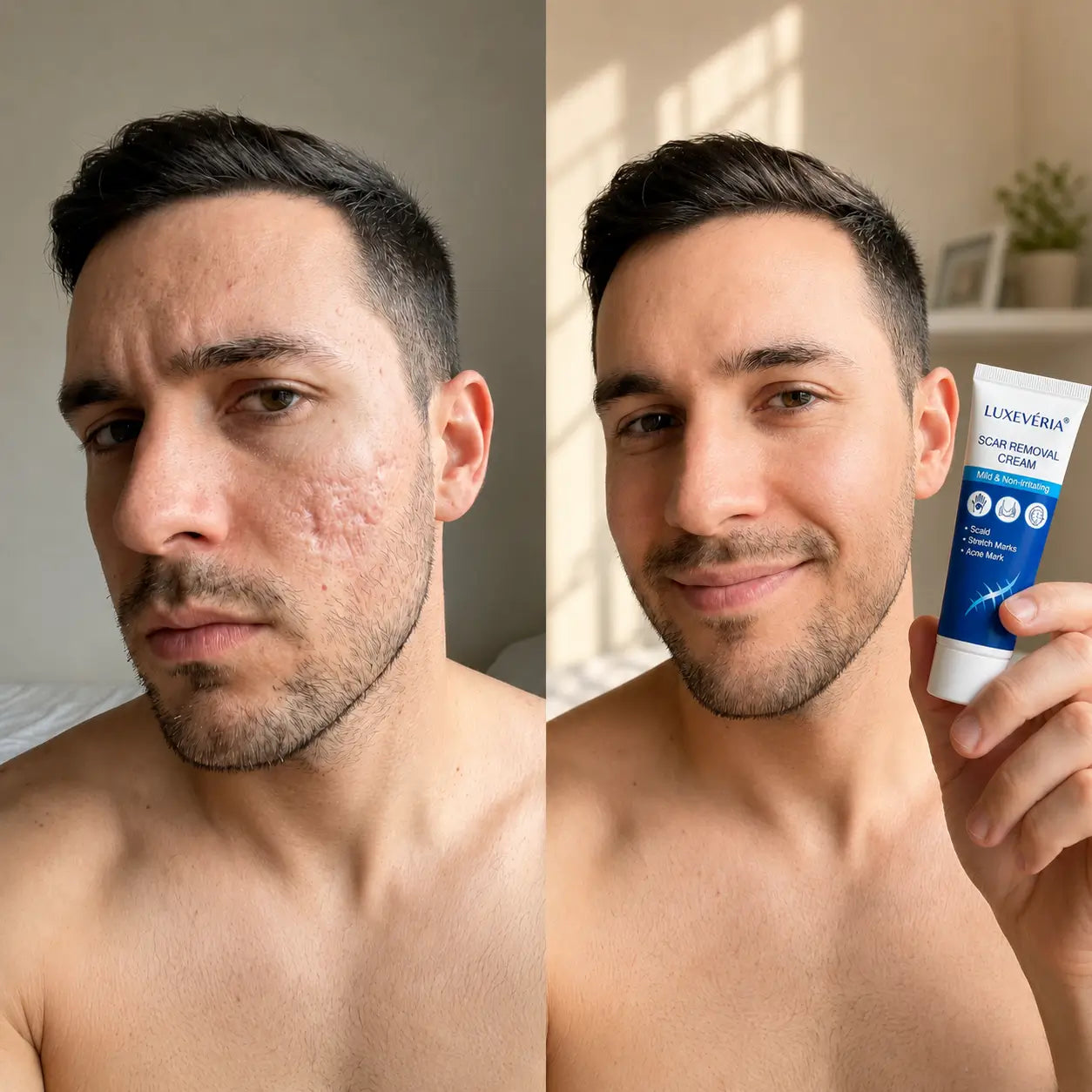 Erase Hardened Scars Completely. Reveal Smooth, Uniform Skin in Days.